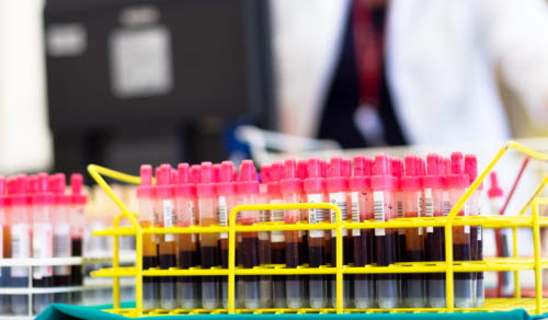 Rack of tubes with blood samples, laboratory technician working in the background.